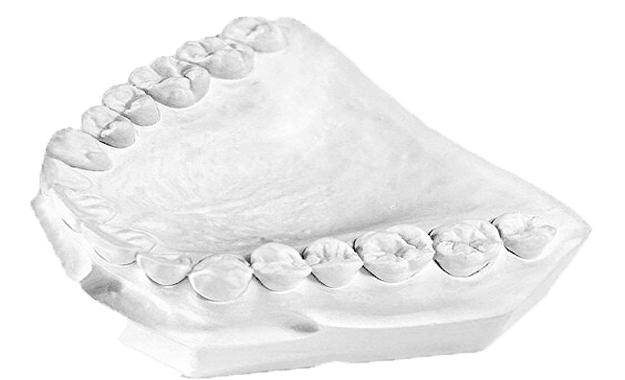 gypsum models dental plasters